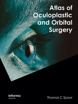 cover image of Atlas of Oculoplastic and Orbital Surgery